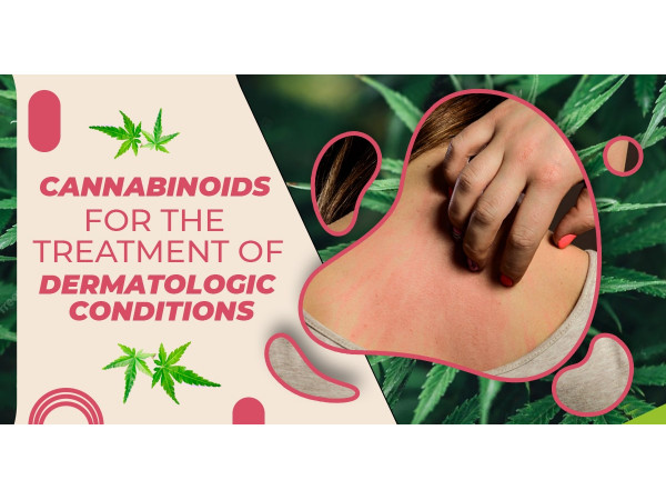 Cannabinoids For The Treatment Of Dermatologic Conditions